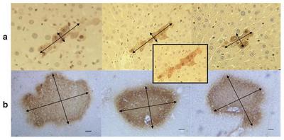 Figure 1.  Elongated shapes of GST-P positive cell clusters in rat livers, early in (a) and late in (b), after administration of a genotoxic carcinogen ([CC BY 4.0](https://creativecommons.org/licenses/by/4.0/): [**Höhme _et al._**](#reference), [Fig. 5](https://link.springer.com/article/10.1007/s11538-017-0375-1/figures/5)). The data show a decreasing aspect ratio of long over short cluster axes from early to late stages.