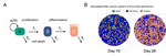 Human Airway Infection